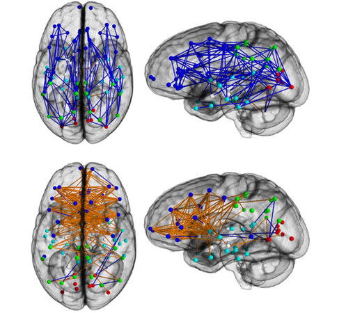 Top: male brain networks Bottom: female brain networks 